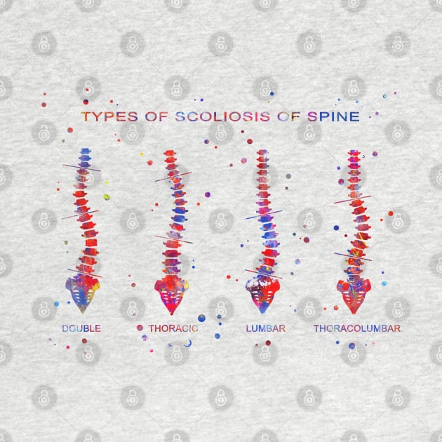 Type of scoliosis of spine by RosaliArt